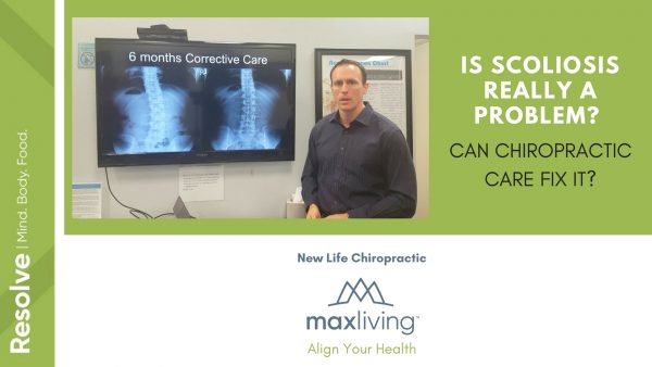 Is Scoliosis Really a Problem Can Chiropractic Care Fix It top image