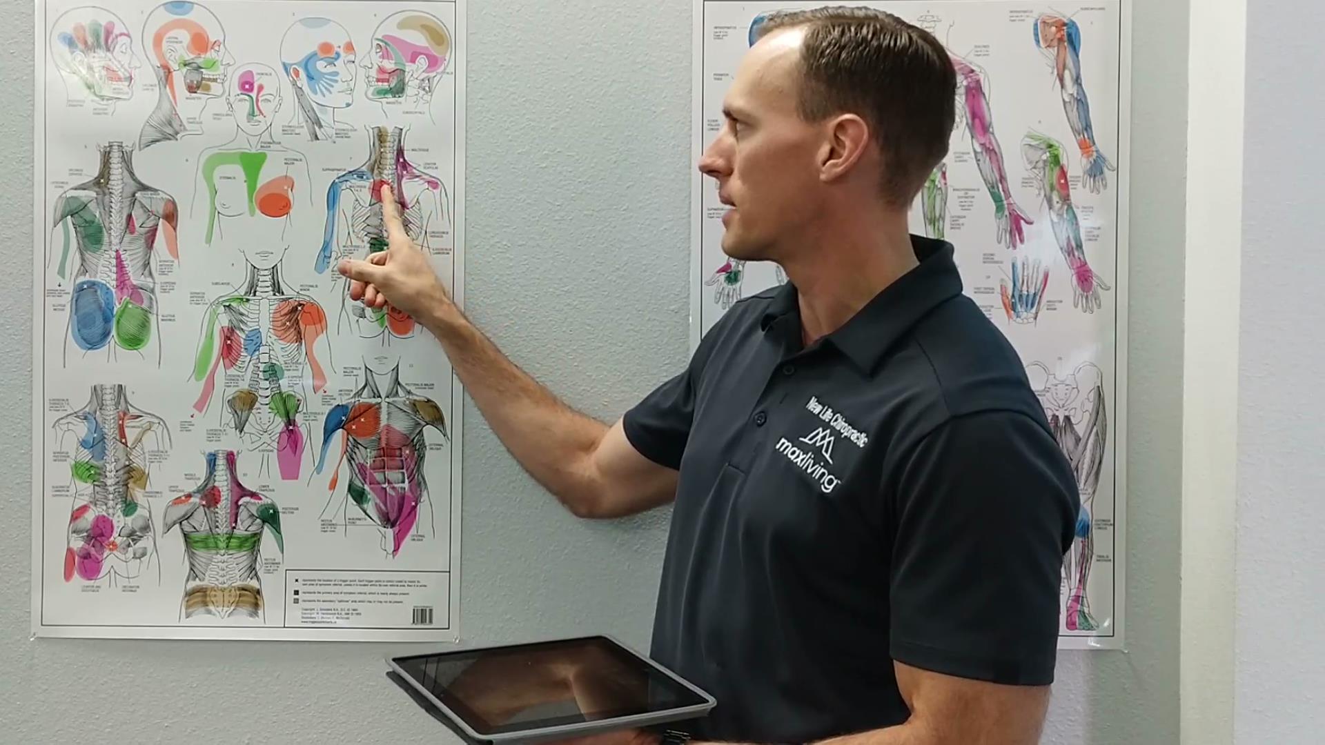 chiropractic chart showing how tech neck creates spinal problems